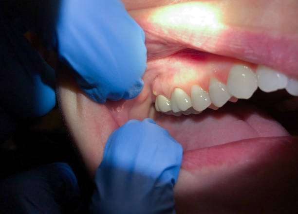 Best Broken Tooth Emergency  in Mantua, UT