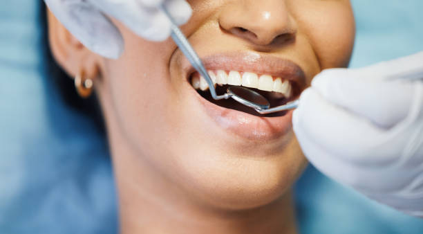 Best Teeth Whitening  in Mantua, UT